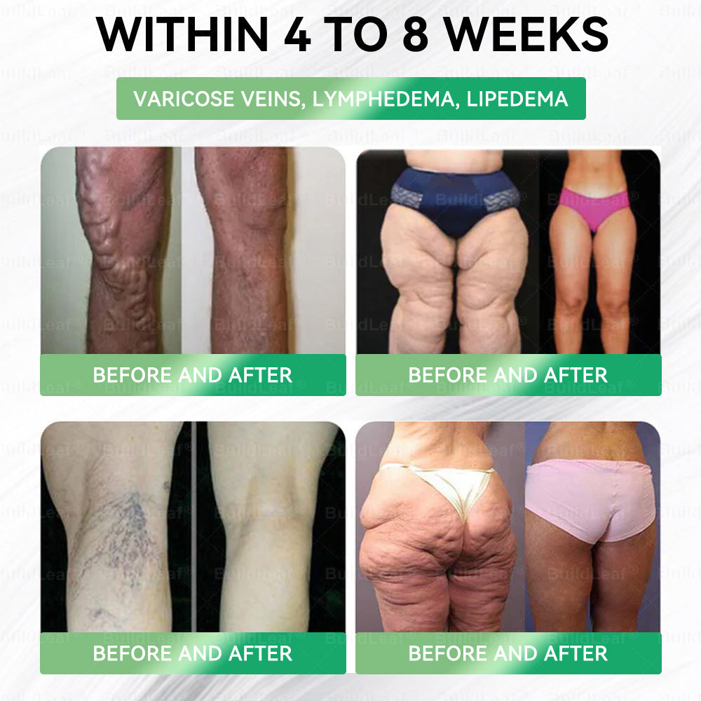 🎁🚀 𝑩𝒖𝐢𝒍𝒅𝑳𝒆𝐚𝒇® – Only 5 Boxes Left! 50% OFF! 🕒 See results in 1–4 weeks! Don’t miss out — offer returns next year! ⏳ Act fast! ✅ 180-day money-back guarantee